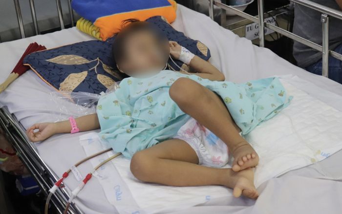 Bé gái mang dị vật dài 16 cm trong bụng suốt 4 tháng