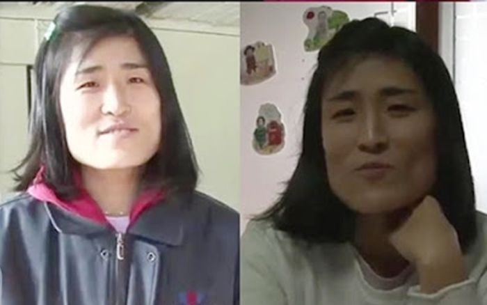 Cô gái xấu xí lột xác thành mỹ nhân sau khi phẫu thuật thẩm mỹ, cưới luôn bác sĩ bệnh viện