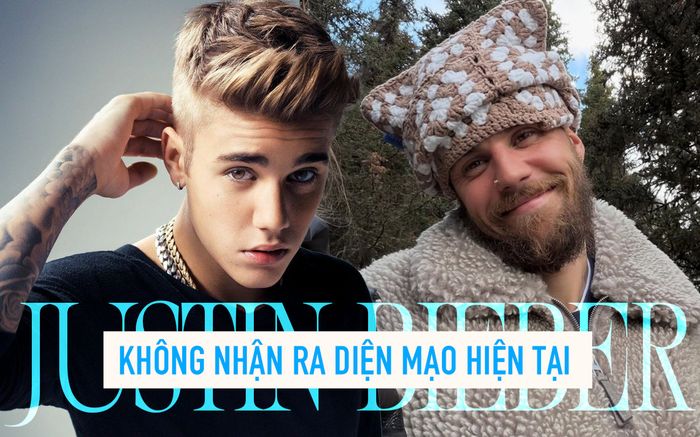 Không nhận ra diện mạo hiện tại của Justin Bieber