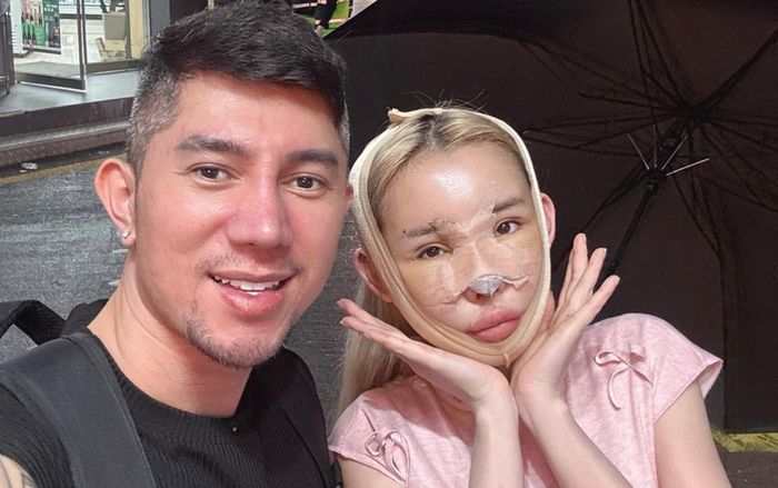 Ngân 98 bị biến dạng mũi nghiêm trọng sau 12 lần 'đập mặt xây lại'