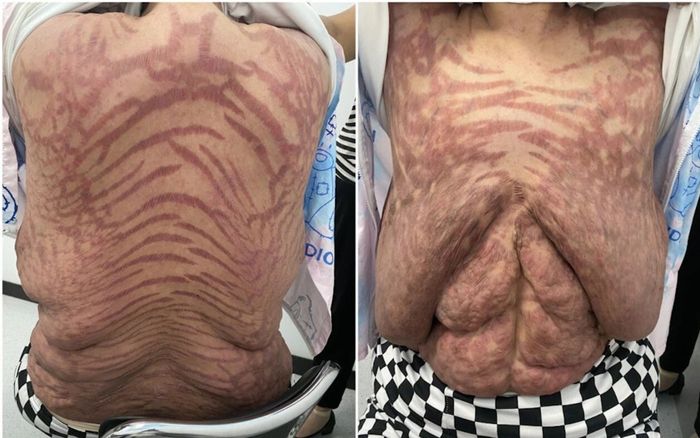 Bôi thuốc trị ngứa mua trên mạng, cơ thể người phụ nữ biến dạng kinh hoàng