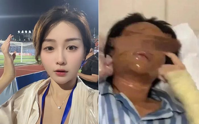 Nữ phát thanh viên xinh đẹp bị biến dạng gương mặt sau khi nhận gói hàng lạ