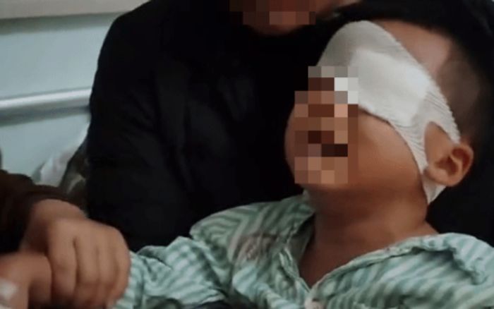 Giáo viên bôi mỡ lợn vào vết thương, cậu bé 4 tuổi bị mù mắt vĩnh viễn