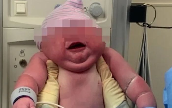 Người mẹ trẻ gây sốc khi sinh con trai nặng gần 6 kg, phá kỷ lục bệnh viện