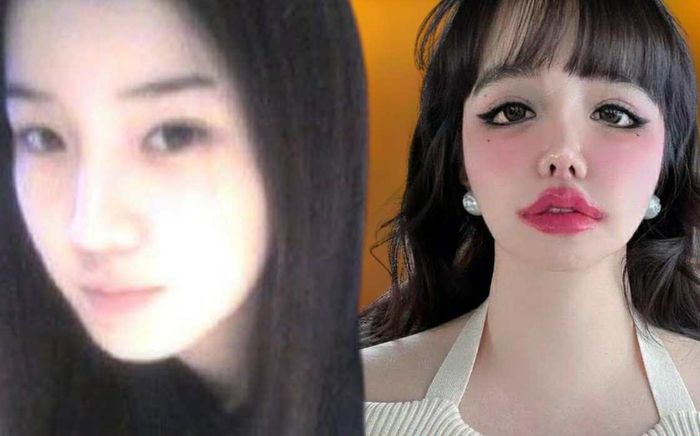 Tiếc cho gương mặt biến dạng của nữ ca sĩ hàng đầu showbiz