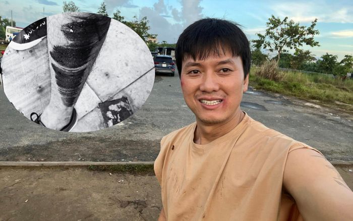 Nam diễn viên Vbiz gặp sự cố giao thông trên đường đi quay, nhiều đồng nghiệp lo lắng gửi lời hỏi thăm