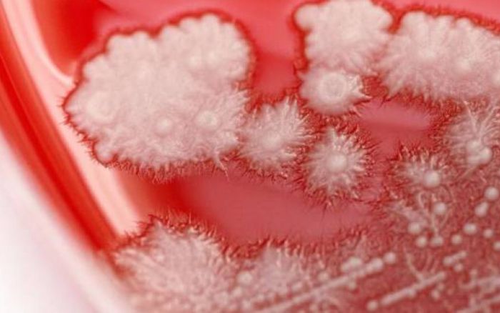 Tự ý dùng kháng sinh do bị đau họng, người đàn ông 36 tuổi gặp tình trạng khiến ai cũng kinh hãi