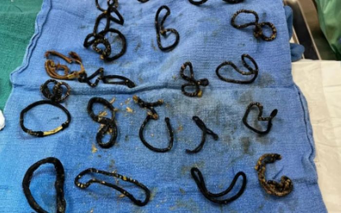 Con mèo bị tắc ruột nghiêm trọng, bác sĩ kiểm tra thì phát hiện sự thật khiến ai cũng bàng hoàng