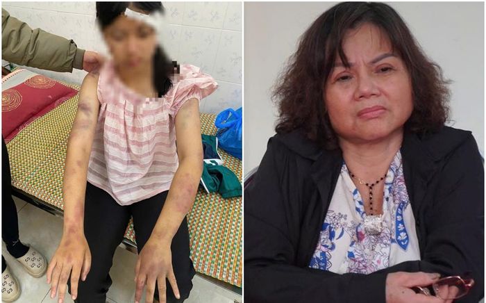 Công an Thái Nguyên thông tin vụ bé gái 13 tuổi bị ông bà đánh dã man