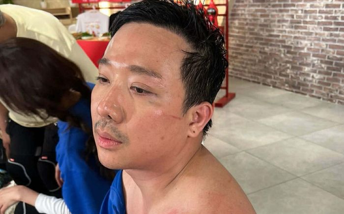 Trấn Thành lộ khoảnh khắc khiến fan xót xa