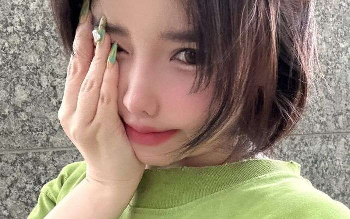 Nữ ca sĩ bị biến dạng khuôn mặt có động thái lạ giữa ồn ào kiện cáo