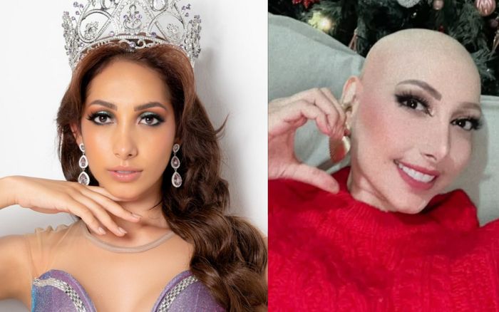 Hoa hậu nổi tiếng showbiz đột ngột qua đời ở tuổi 28