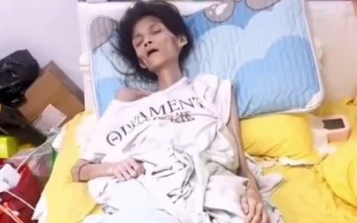 Cô gái 27 tuổi nặng 17kg qua đời, câu chuyện đằng sau khiến dư luận đau xót