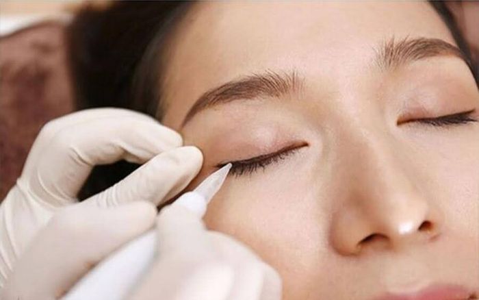 Phun mí là gì và cần cân nhắc những yếu tố nào trước khi thực hiện?