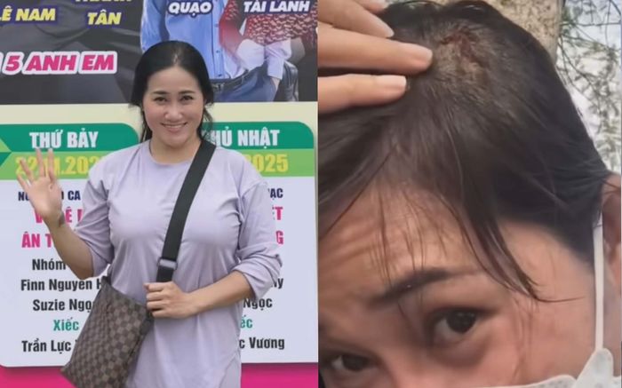 Xôn xao ca sĩ Vũ Trâm Anh bị cướp điện thoại, té bể đầu