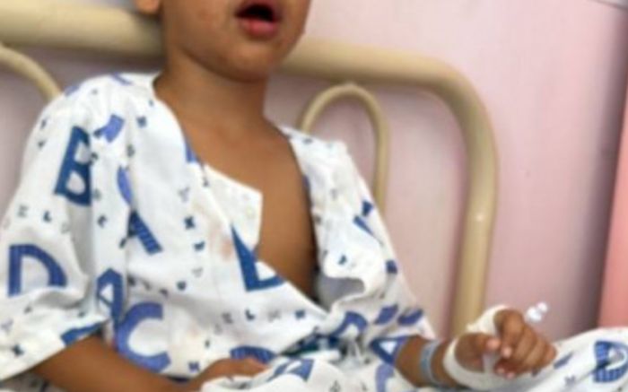 Bé trai phải nhổ một lúc 12 chiếc răng, nguyên nhân xuất phát từ thói quen khó bỏ