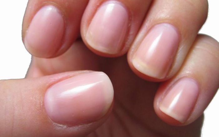 Nếu có đủ 6 dấu hiệu này, xin chúc mừng bạn đang cực kỳ khỏe mạnh