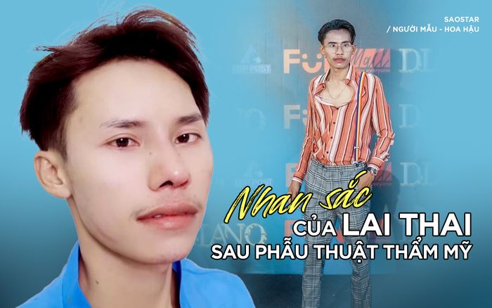 Bất ngờ với nhan sắc của Lai Thai sau khi phẫu thuật thẩm mỹ ở Việt Nam