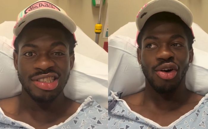 Rapper Lil Nas X bị liệt nửa mặt
