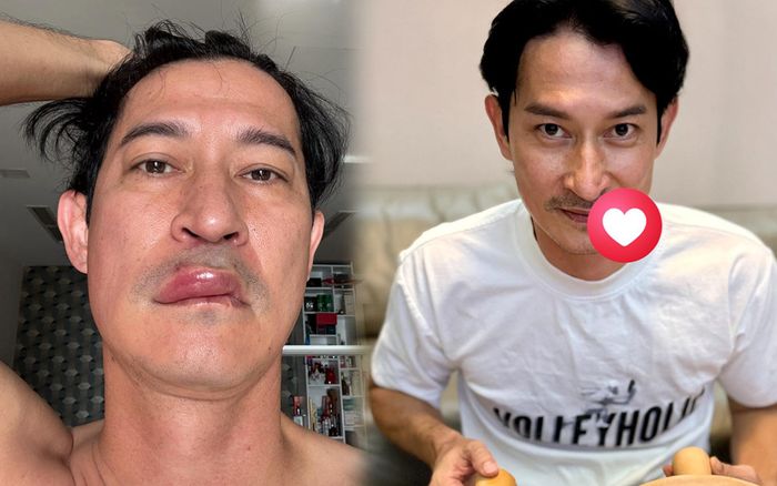 Tình trạng hiện tại của Huy Khánh sau biến cố sức khỏe