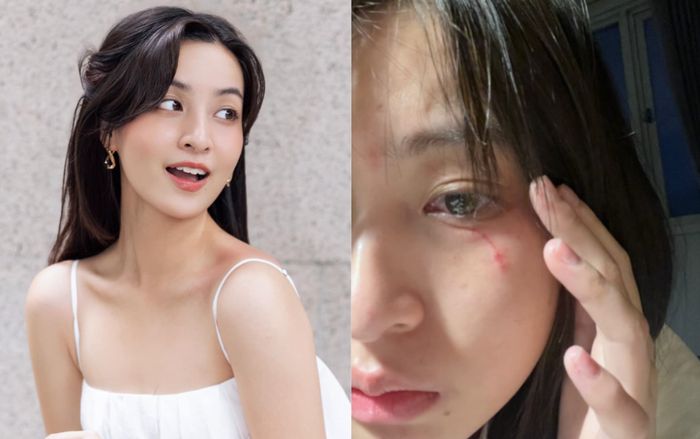 Sao nữ Vbiz bị thú cưng 'tấn công', tình trạng gây xót xa