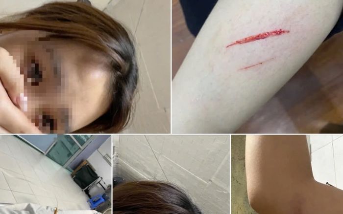 Công an xác minh vụ nữ sinh viên bị hành hung vì tiền tip trong khi làm thêm ở nhà hàng