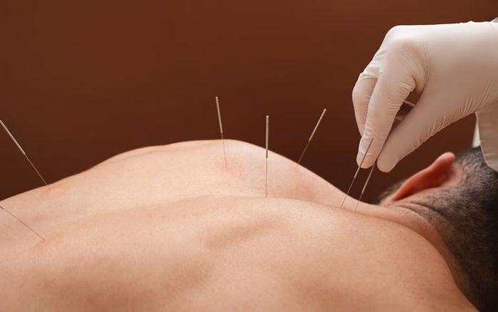 Đi châm cứu tại quán cà phê, người đàn ông gặp biến chứng suýt mất mạng