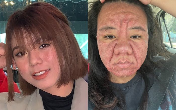 Mẹ bầu hoảng loạn vì 'biến dạng' gấp 10 lần trong thai kỳ