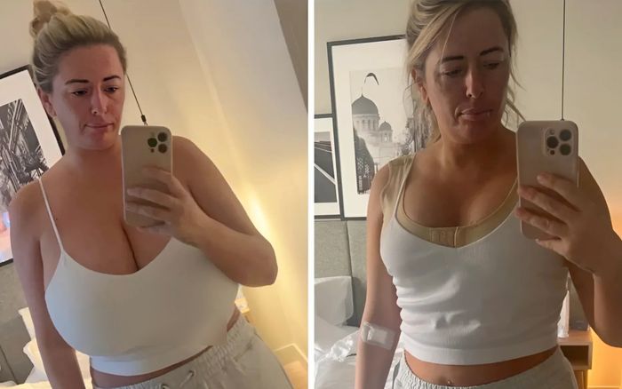 'Khủng hoảng vì vòng 1 quá cỡ'