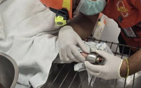 Dùng ngón tay mở ổ khóa cửa, cô gái nhận cái kết ai nhìn cũng 'nhăn mặt'