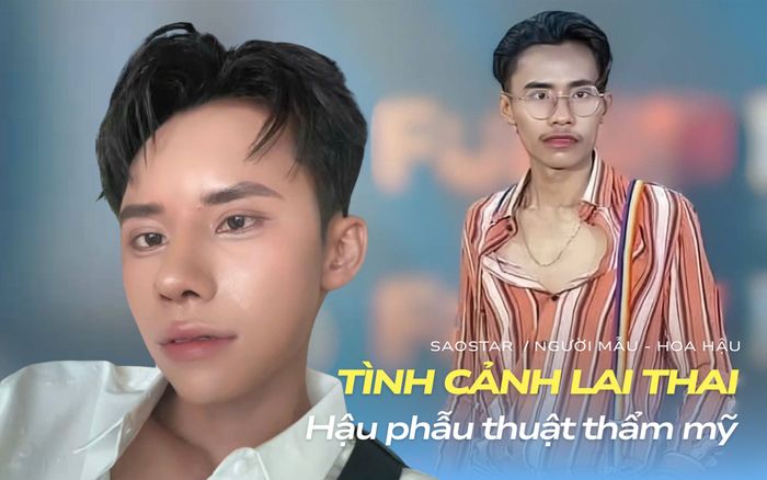 Tình thế đảo ngược của Lai Thai hậu phẫu thuật thẩm mỹ