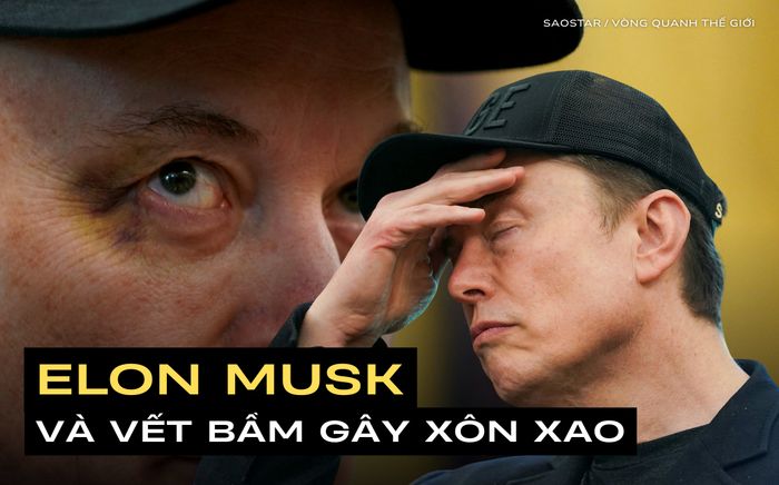 Elon Musk rời Nhà Trắng với con mắt bầm tím