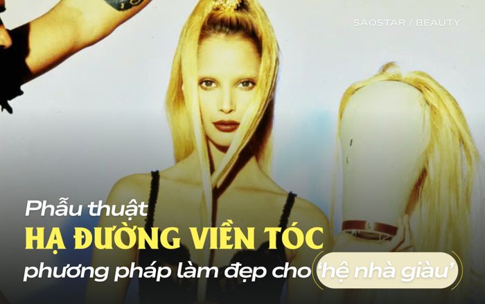 Phẫu thuật hạ đường viền tóc có gì mà được định giá hơn nửa tỷ đồng?