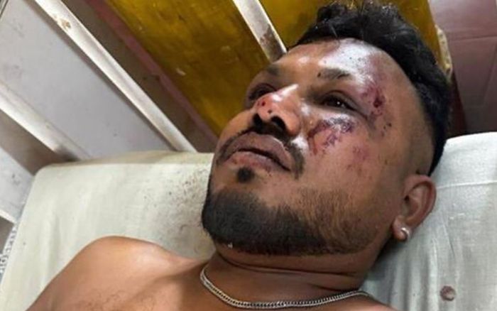 Người đàn ông duy nhất sống sót kể lại toàn bộ quá trình vụ rơi máy bay Ấn Độ