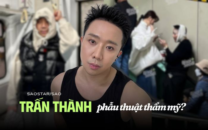 Trấn Thành bị bạn thân 'tố' can thiệp thẩm mỹ?