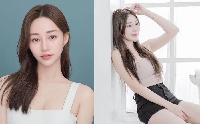 Chi tiết bí ẩn vụ nữ người mẫu vừa qua đời ở tuổi 40 do trị liệu mất ngủ