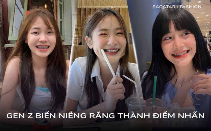 Không chỉ là thẩm mỹ, niềng răng trở thành 'phụ kiện' thời trang của Gen Z