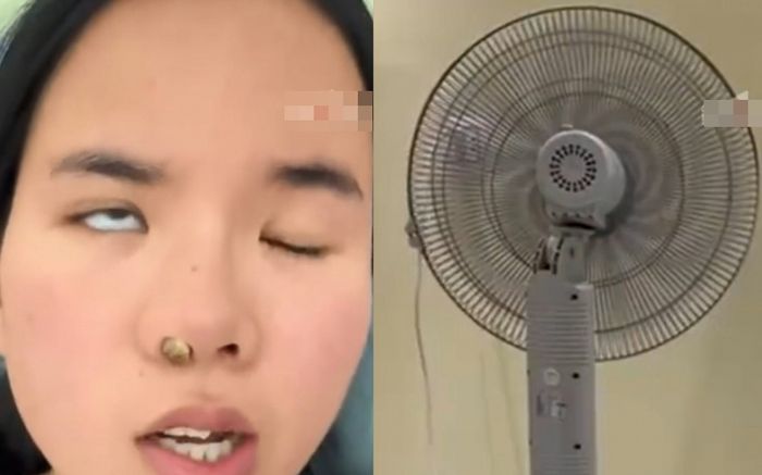 Cô gái bị liệt mặt vì bật quạt máy ngủ trưa, bác sĩ đưa ra lời cảnh báo