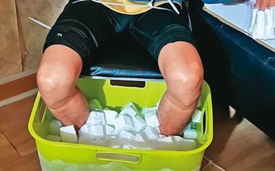 Nam sinh viên ngâm chân trong đá khô suốt 10 tiếng để trục lợi bảo hiểm, hậu quả đau lòng