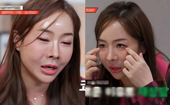 Nữ diễn viên ham 'dao kéo' và gương mặt méo mó đáng sợ