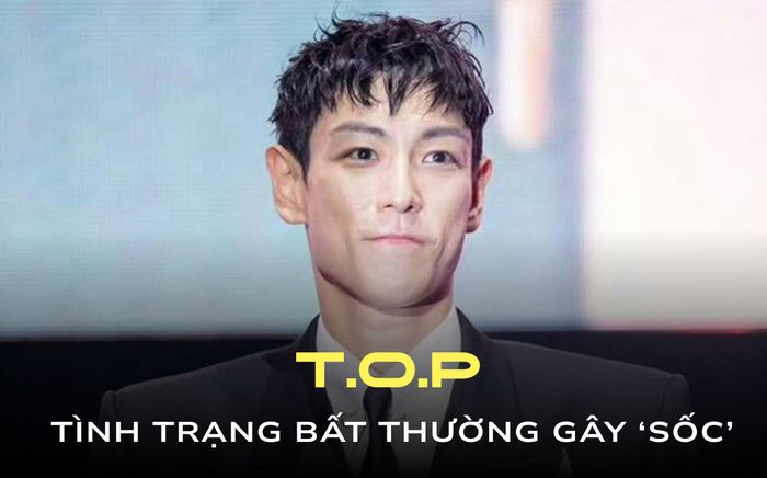 Trạng thái bất thường của T.O.P (BIGBANG)