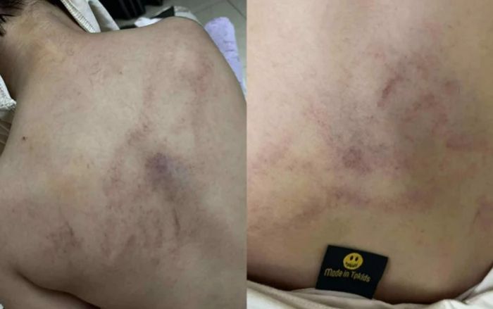 Vụ bé gái 4 tuổi bị cô giáo bạo hành tại lớp học: Camera ghi lại gì?