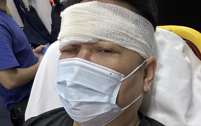 Nam ca sĩ gặp tai nạn xe trên đường đi làm, gương mặt bị thương nghiêm trọng