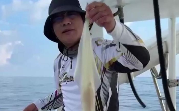 Ăn hải sản suốt 30 năm, người đàn ông 64 tuổi bị tổn thương thận mà không hề hay biết