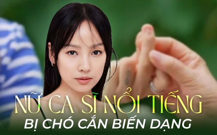Nữ ca sĩ nổi tiếng bị biến dạng một bộ phận cơ thể vì chó cắn, hình ảnh khiến ai cũng đau lòng