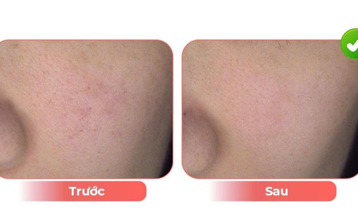 Lão hóa sắc tố là gì?