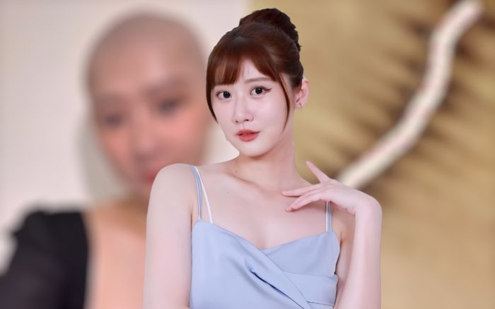 Xót xa nữ diễn viên cạo sạch tóc, tăng 20 kg sau nửa năm điều trị ung thư