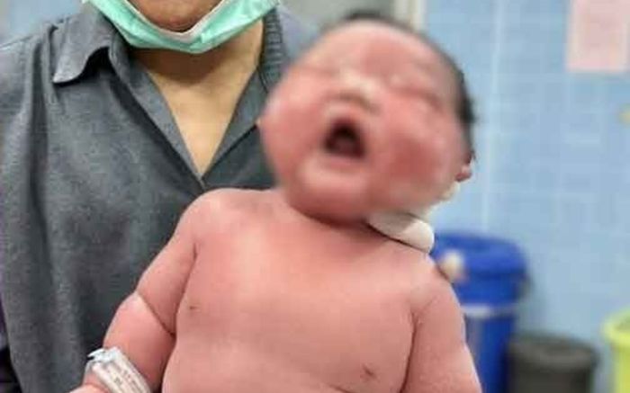 Sản phụ sinh ra em bé 'khổng lồ' khiến cả bệnh viện xôn xao
