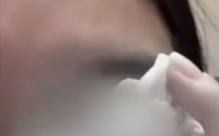 Từ chối quay lại sau chia tay, hành động của bạn trai khiến cô gái bị mù mắt