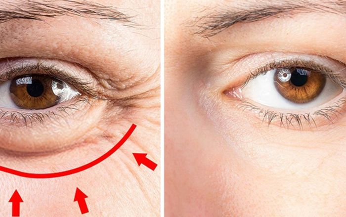 Mắt có 4 thay đổi này, đi khám ngay – dấu hiệu tiềm ẩn nhiều loại ung thư mà ít ai biết